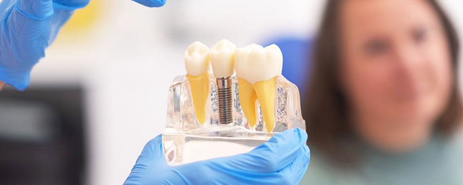 Dental Implant Treatment